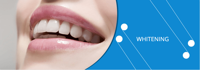 teeth whitening miami