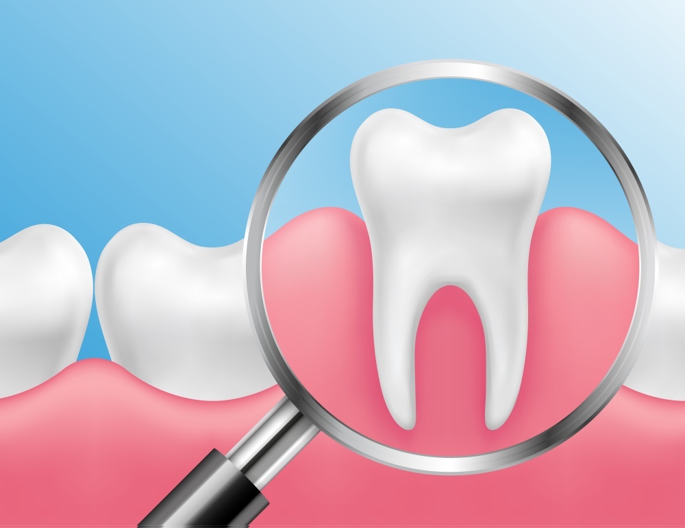 Implications of Dental Implants Sher Dental North Miami Dentist 