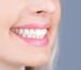 Dental Implants in Aventura FL