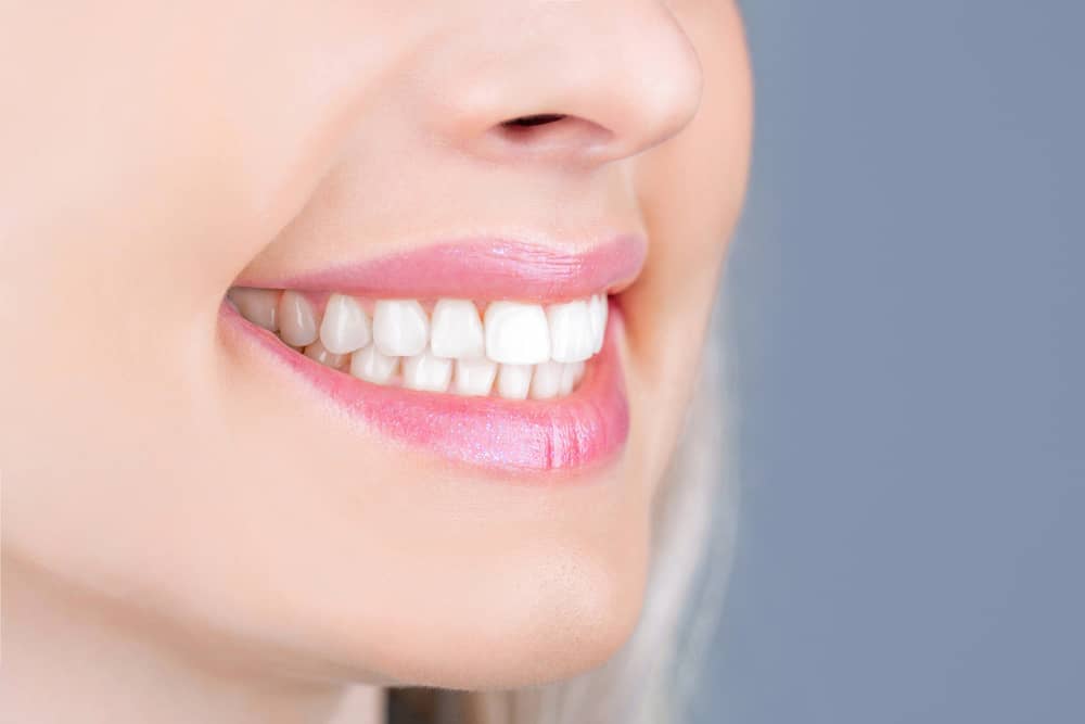 Dental Implants in Aventura FL