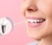 Dental implants north miami