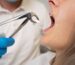 emergency dental services Aventura FL