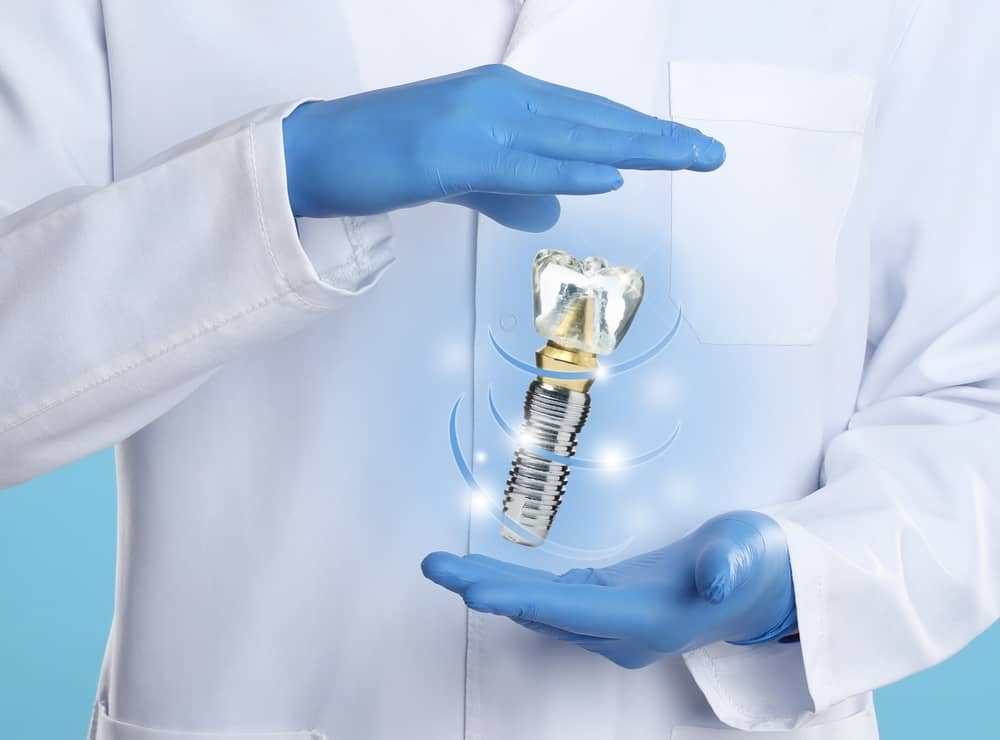 best dental implants Miami FL