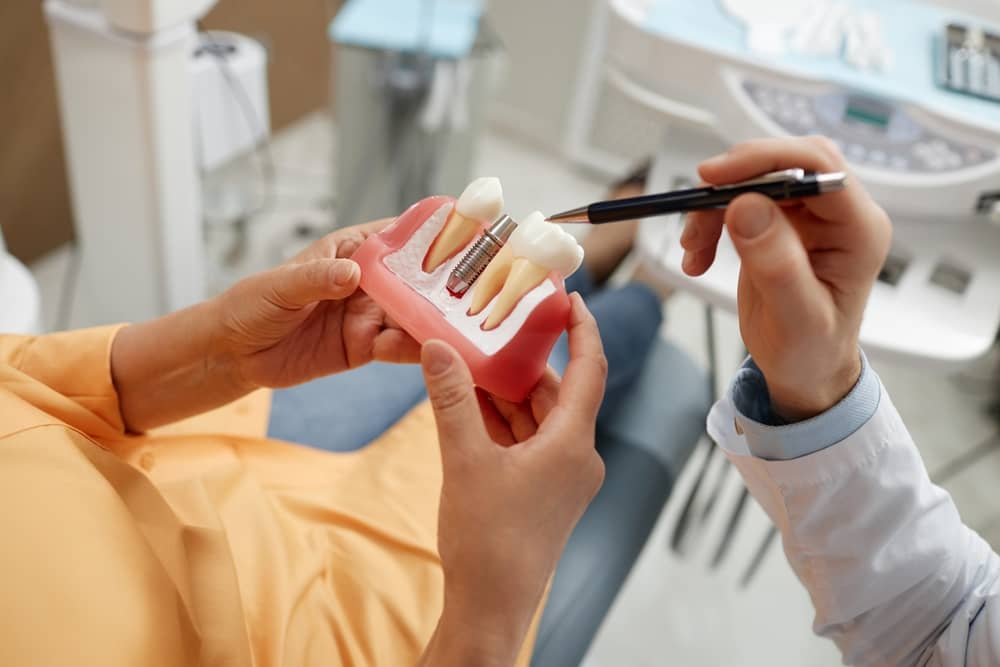 Dental implants Miami FL