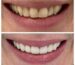 emergency dental services aventura fl