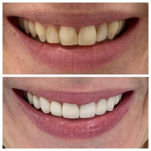 emergency dental services aventura fl