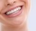 dental implants in miami fl