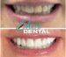 cosmetic dentist Aventura fl