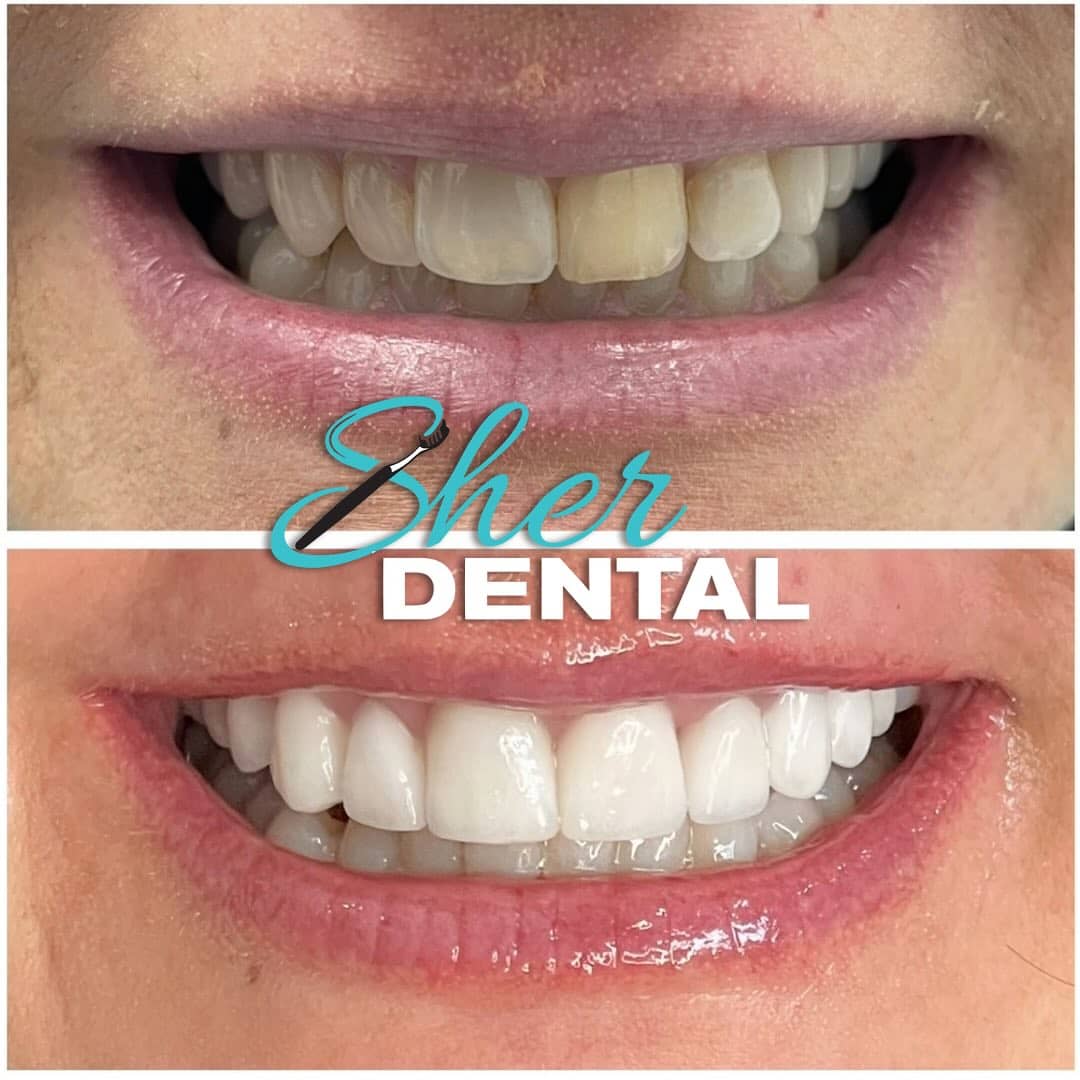 cosmetic dentist Aventura fl